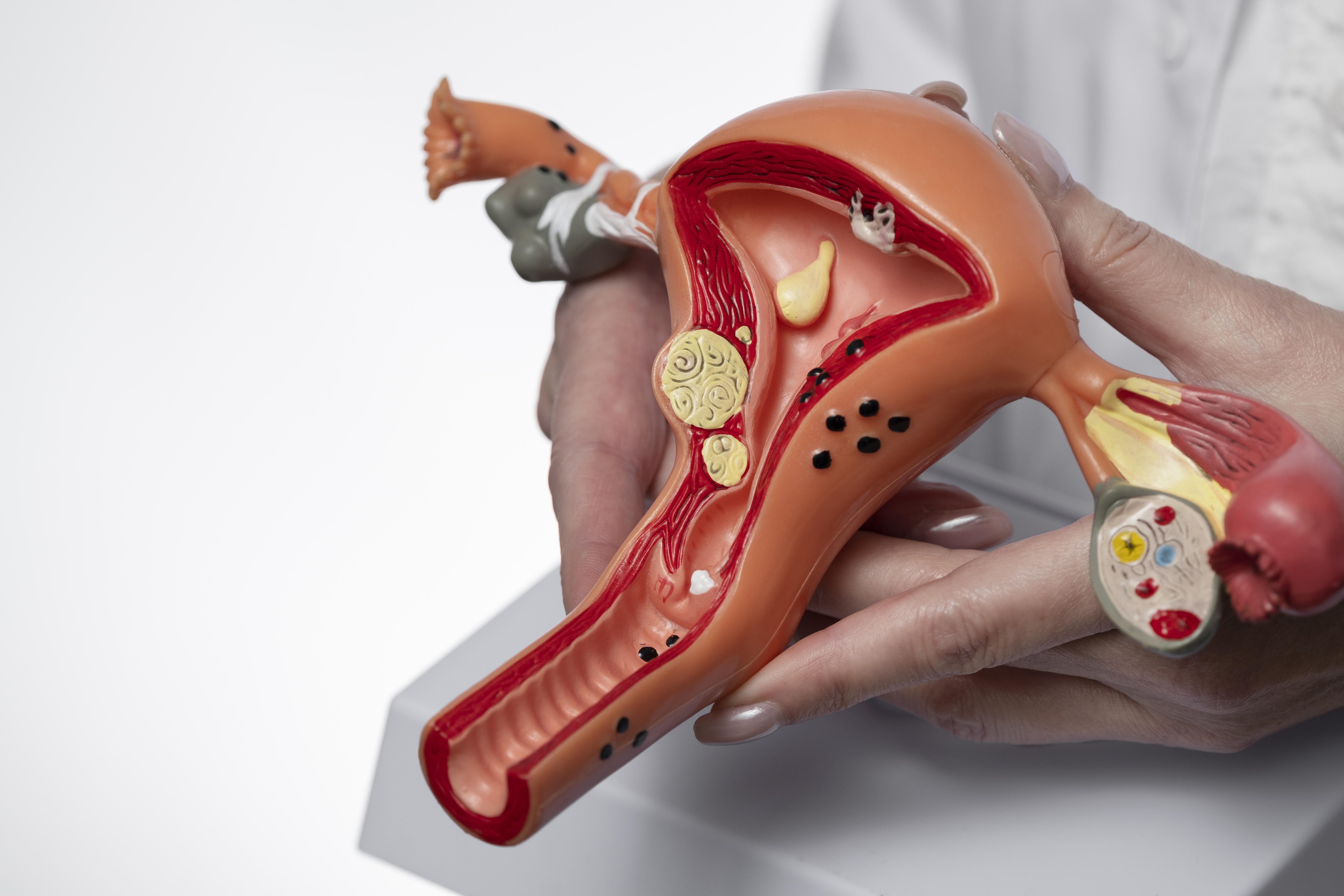Cervical Cancer: What Every Woman Needs to Know About Prevention and Treatment